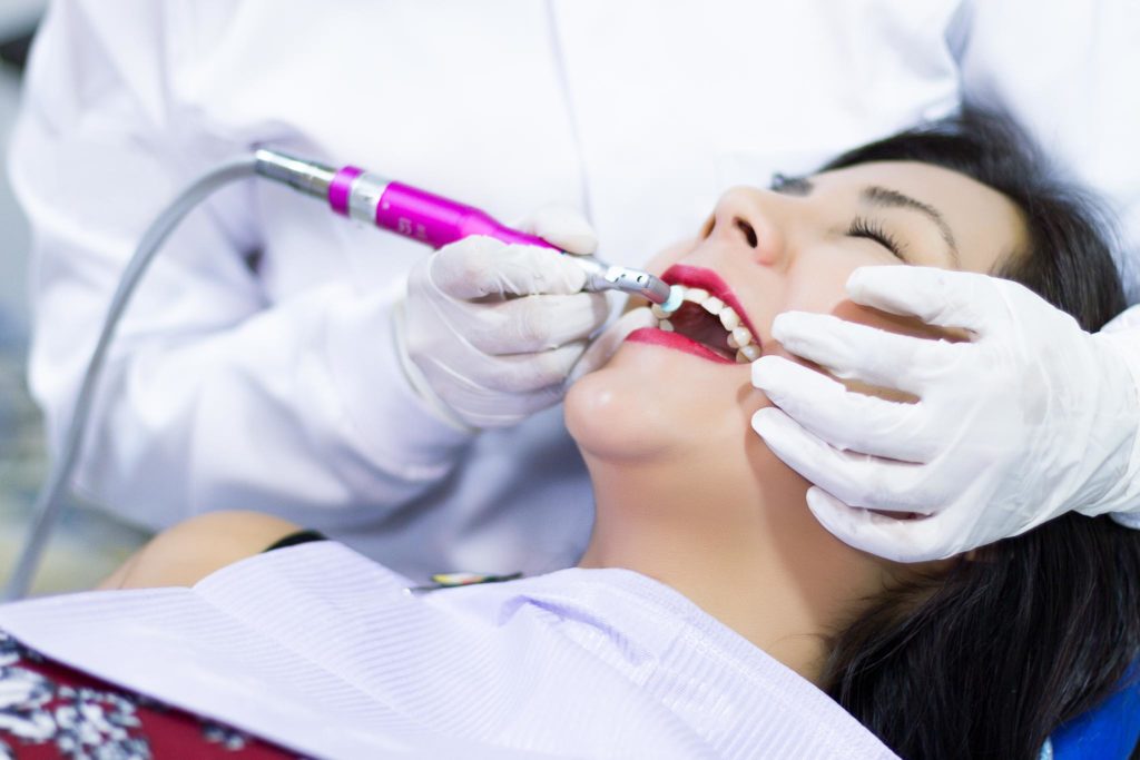 Limpieza dental - Profilaxis